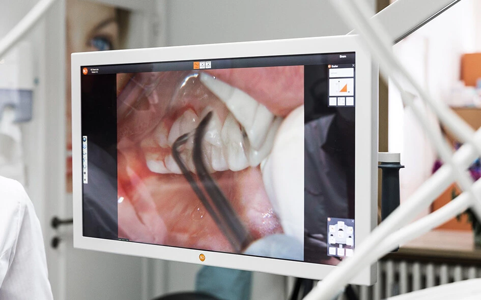 During the Dental Treatment Doctor shows that on the monitor